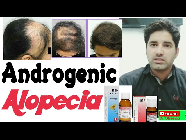 Androgenic Alopecia treatment ! Hair loss and hair growth medicine ?Full  explain!#drsherazihomeopath دیدئو dideo