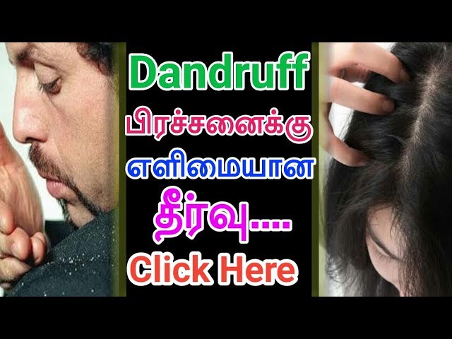how to remove dandruff in tamil | home remedy to solve dandruff | podugu  nenga tips | reduce fast دیدئو dideo